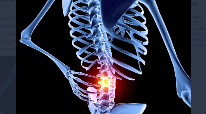 Low Back Pain: Top New Approaches To Treatment