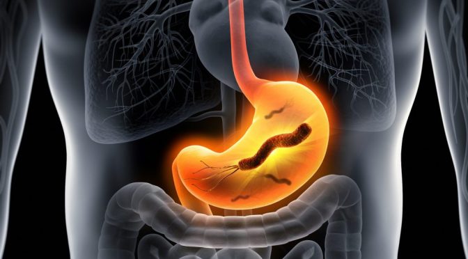 Bacteria: Helicobacter Pylori Infection Review