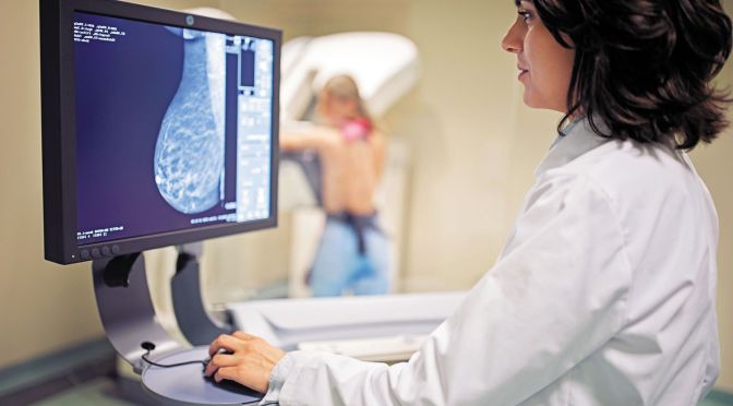 Mammograms: How They Can Reveal Heart  Disease
