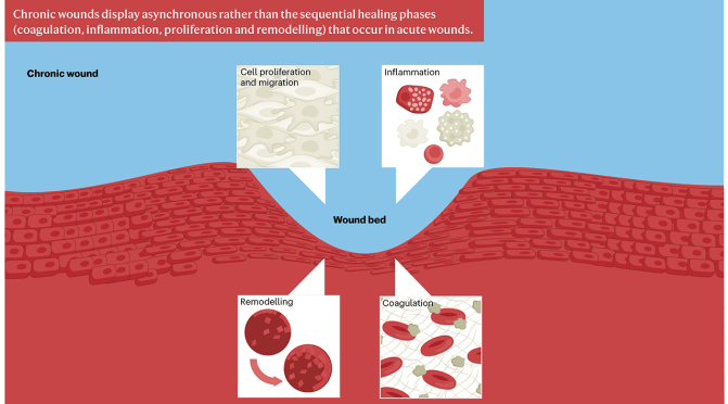 Infographics: Chronic Wounds In Older Adults