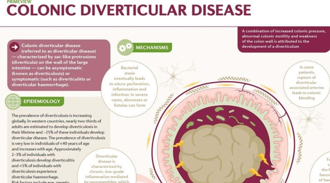 Infographic: Colonic Diverticular Disease
