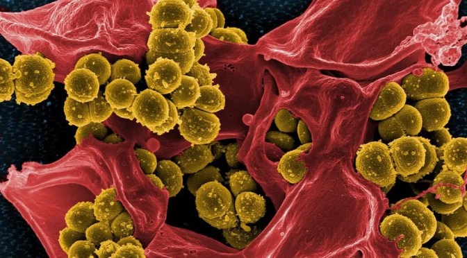 Dr. C’s Journal: MRSA- Methicillin Resistant Staphylococcus Aureus