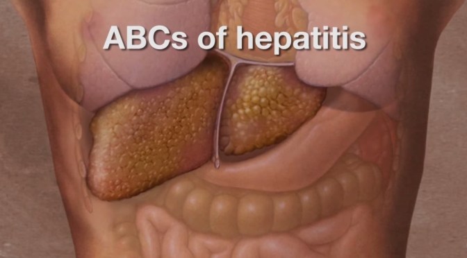 Medicine: The ABCs Of Hepatitis (Mayo Clinic)