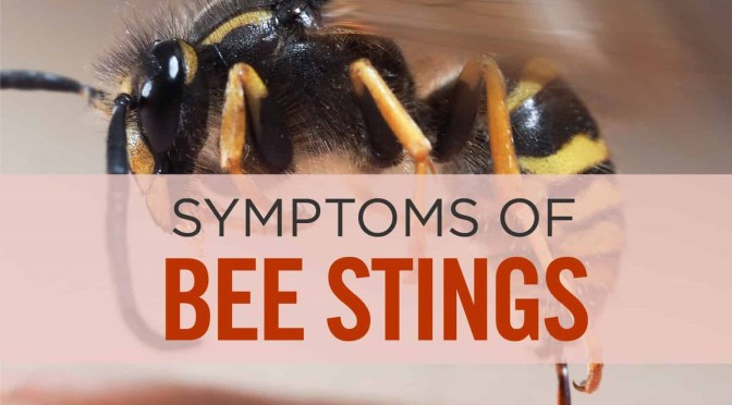 Dr. C’s Journal: Bee Sting Allergies And Reactions