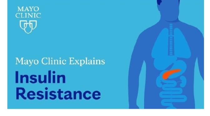Insulin Resistance: Risk Factors And Treatment