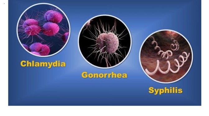 Dr. C’s Journal: What Are Symptoms Of Gonorrhea?
