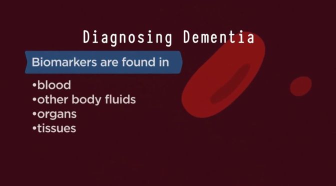 AGING: HOW BIOMARKERS HELP DIAGNOSE DEMENTIA
