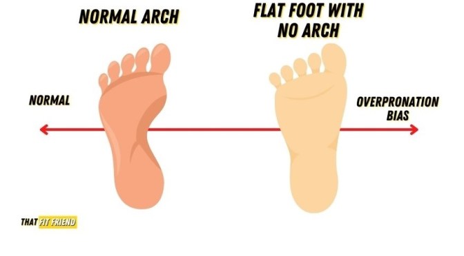 Dr. C’s Journal: Flat Feet And Overpronation
