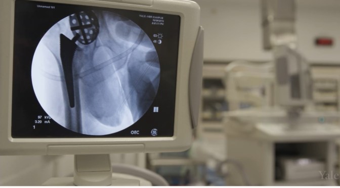 Medicine: Using Stem Cells To Treat Osteonecrosis