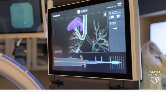 Lung Cancer Diagnosis: Robotic Bronchoscopy