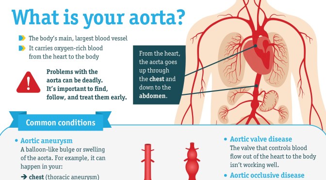 Infographic: Conditions That Cause Aortic Disease