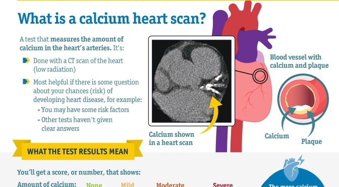 Cardiology: What Is A Calcium Heart Scan?