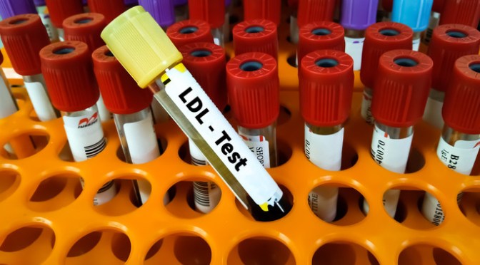 Heart Disease: The Best Ways To Lower High LDL Cholesterol Levels