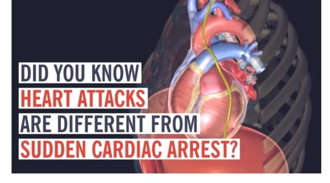 Reviews: Heart Attacks Vs. Sudden Cardiac Arrest