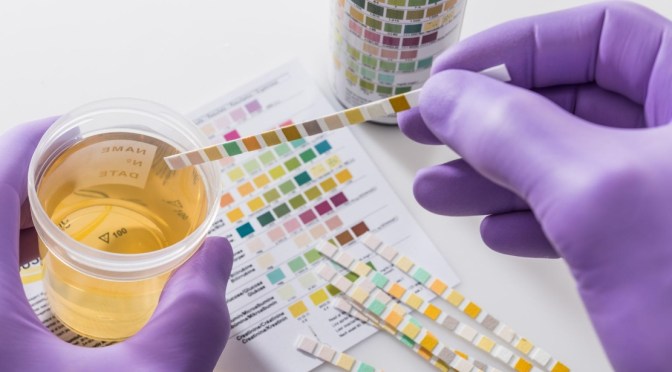 Screening Tests: What Makes Up A Urinalysis?