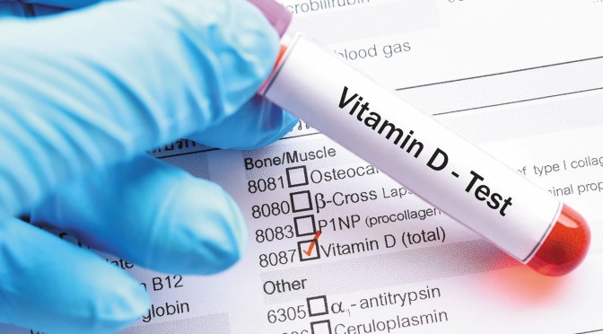 Vitamin D: Importance Of Knowing Blood Levels