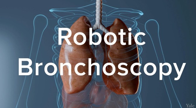 Lung Cancer: Benefits Of Robotic Bronchoscopy