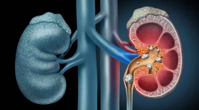 Chronic Kidney Disease: New Medication Review