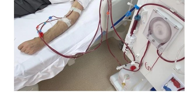 Kidney Failure Reviews: The History Of Dialysis