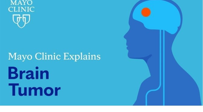 Reviews: Brain Tumor Risk Factors & Symptoms