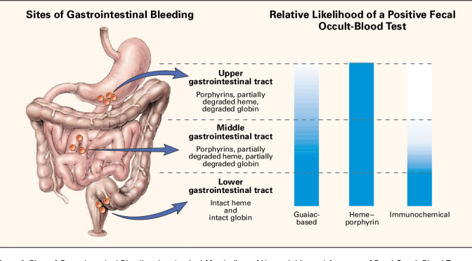 Review: Gastrointestinal Bleeding Management