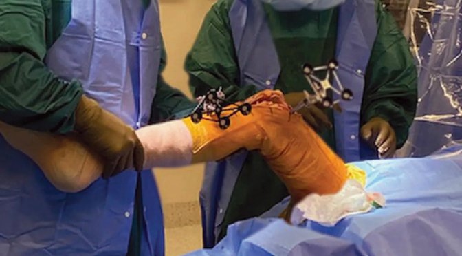 Reviews: Robotic Knee Replacement Surgery